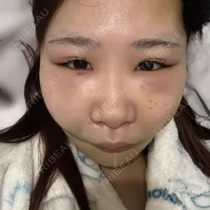 Nebula Clinic 新宿美容外科ネビュラクリニック口コミ