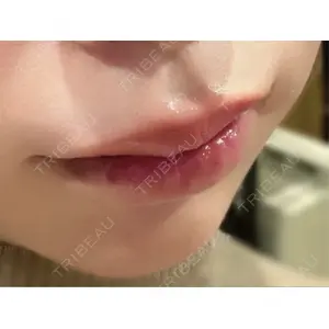 口コミ