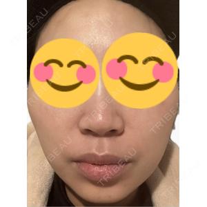 エルムクリニック 美容皮膚科エルムクリニック 麻布院口コミ