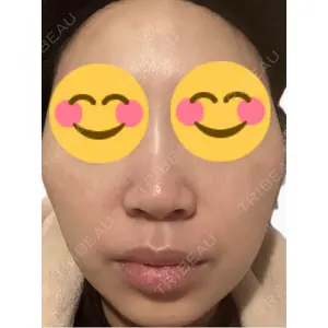 南青山コスメクリニック口コミ