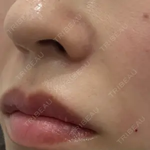 TCB東京中央美容外科 TCB東京中央美容外科 名古屋栄院口コミ