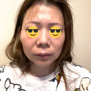 TCB東京中央美容外科 TCB東京中央美容外科 新潟院口コミ