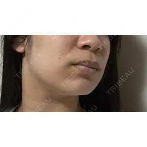 ルラ美容クリニック ルラ美容クリニック 宇都宮院口コミ