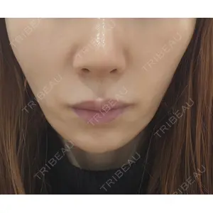 ヴェリテクリニック ヴェリテクリニック 銀座院口コミ