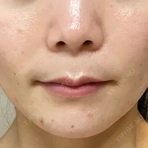 ルラ美容クリニック ルラ美容クリニック 宇都宮院口コミ