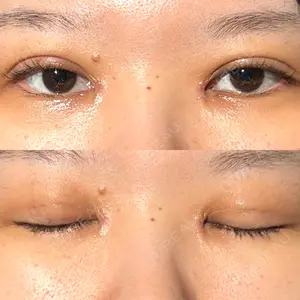 東京シンデレラ美容外科 東京シンデレラ美容外科 池袋院口コミ