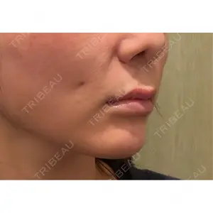 アイビークリニック 千葉美容外科アイビークリニック口コミ