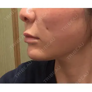 アイビークリニック 千葉美容外科アイビークリニック口コミ