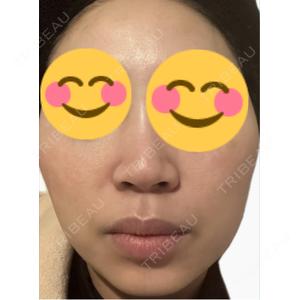 エルムクリニック 美容皮膚科エルムクリニック 麻布院口コミ