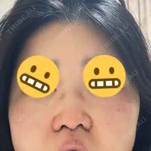 東京シルククリニック 東京シルククリニック 新宿院口コミ