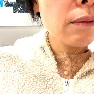 南青山コスメクリニック口コミ