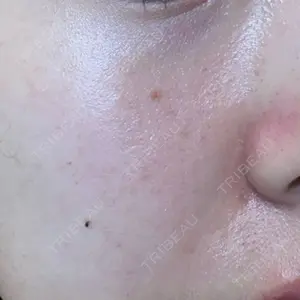 やさしい美容皮膚科・皮フ科 やさしい美容皮膚科・皮フ科　秋葉原院口コミ