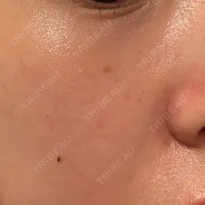 やさしい美容皮膚科・皮フ科 やさしい美容皮膚科・皮フ科　秋葉原院口コミ