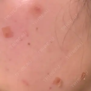 心斎橋KT美容クリニック口コミ