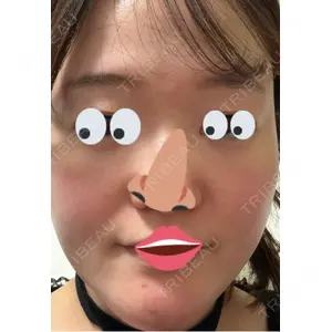 やさしい美容皮膚科・皮フ科 やさしい美容皮膚科・皮フ科　秋葉原院口コミ