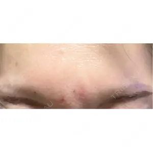 NARU Beauty Clinic NARU Beauty Clinic 【ナルクリ】 水戸院口コミ