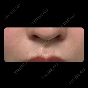 TCB東京中央美容外科 TCB東京中央美容外科 名古屋栄院口コミ