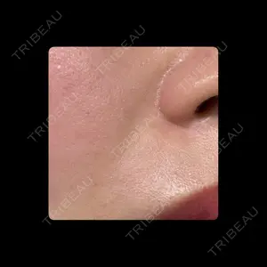 TCB東京中央美容外科 TCB東京中央美容外科 名古屋栄院口コミ