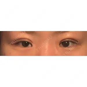 アリエル美容クリニック アリエル美容クリニック 水戸院口コミ