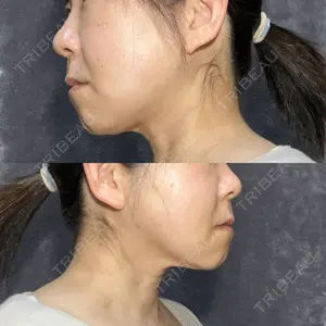 アリエル美容クリニック アリエル美容クリニック 水戸院口コミ