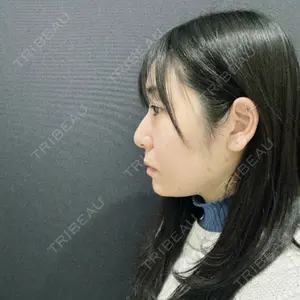 YBC横浜美容外科 YBC横浜美容外科 立川院口コミ