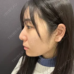 YBC横浜美容外科 YBC横浜美容外科 立川院口コミ