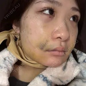 Nebula Clinic 新宿美容外科ネビュラクリニック口コミ