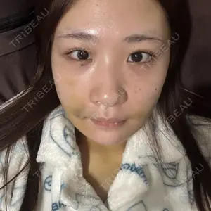 Nebula Clinic 新宿美容外科ネビュラクリニック口コミ