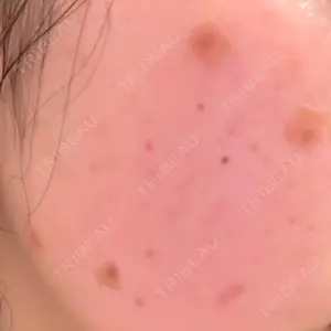 心斎橋KT美容クリニック口コミ