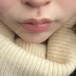 ルラ美容クリニック ルラ美容クリニック 大阪本院口コミ