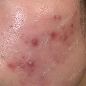 AURORA CLINIC（オーロラクリニック）新宿院口コミ