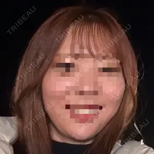 BON BON CLINIC BON BON CLINIC 銀座駅前本院口コミ