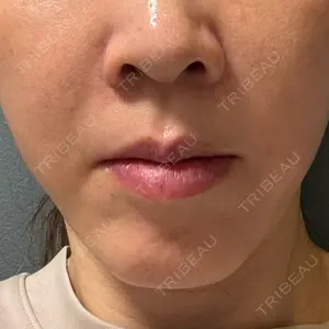 TCB東京中央美容外科 TCB東京中央美容外科 銀座有楽町院口コミ