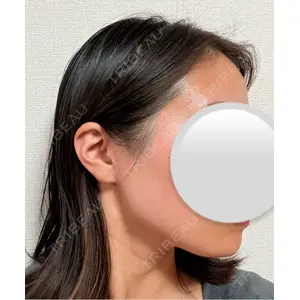 アリエル美容クリニック アリエル美容クリニック 水戸院口コミ