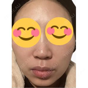 エルムクリニック 美容皮膚科エルムクリニック 麻布院口コミ