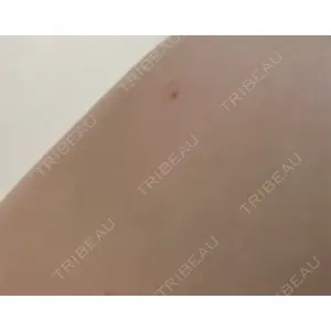 アイビークリニック 吉祥寺アイビークリニック口コミ