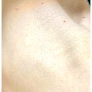 エルムクリニック 美容皮膚科エルムクリニック 麻布院口コミ