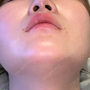 東京美容皮膚科アロエクリニック 東京美容皮膚科アロエクリニック池袋口コミ