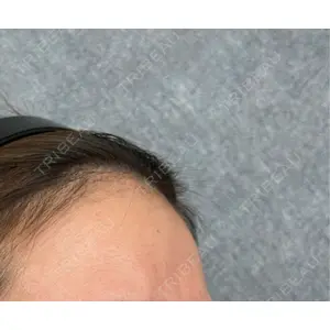 ルラ美容クリニック ルラ美容クリニック 岡山院口コミ