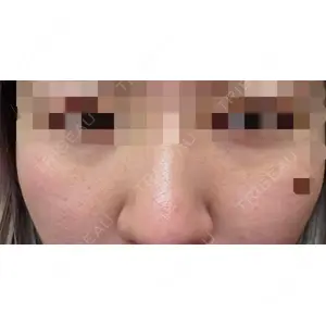 TCB東京中央美容外科 TCB東京中央美容外科 高崎院口コミ