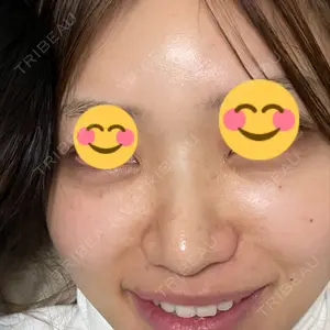 TCB東京中央美容外科 TCB東京中央美容外科 銀座有楽町院口コミ