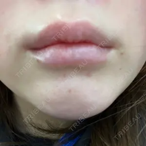 東京美容皮膚科アロエクリニック 東京美容皮膚科アロエクリニック池袋口コミ