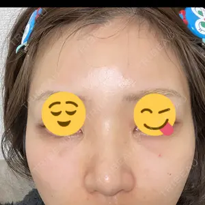 TCB東京中央美容外科 TCB東京中央美容外科 銀座有楽町院口コミ