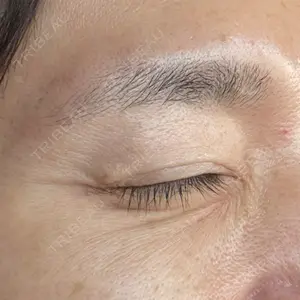 TCB東京中央美容外科 TCB東京中央美容外科 豊田院口コミ