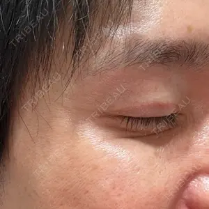 TCB東京中央美容外科 TCB東京中央美容外科 豊田院口コミ