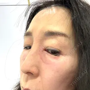 口コミ