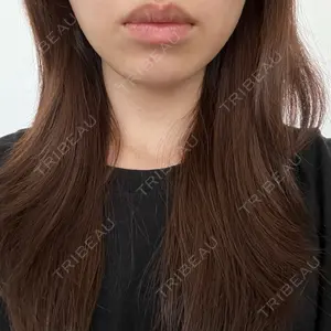 共立美容外科・歯科 共立美容外科 梅田院口コミ