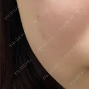 おおたかの森ビューティークリニック おおたかの森ビューティークリニック口コミ