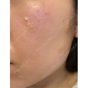 Fellez Clinic【フェルズクリニック】口コミ