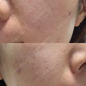 東京シルククリニック 東京シルククリニック 新宿院口コミ